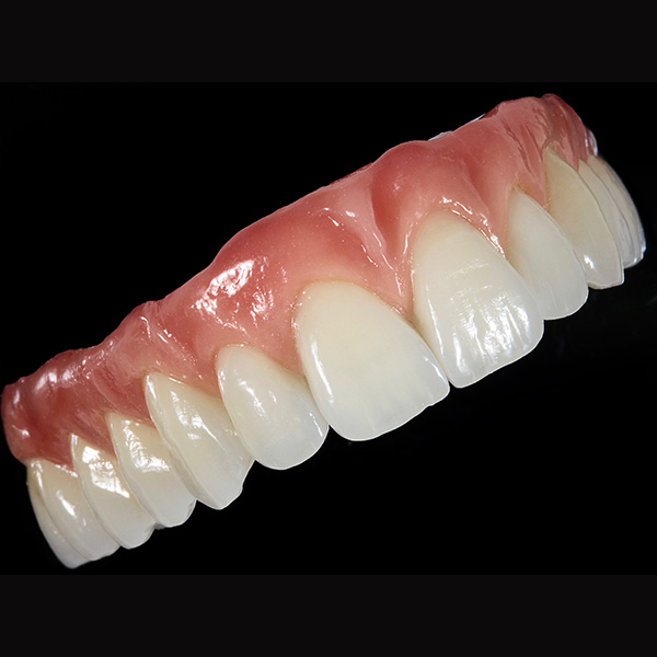 La encía y los dientes crearon una unidad idéntica al modelo natural.