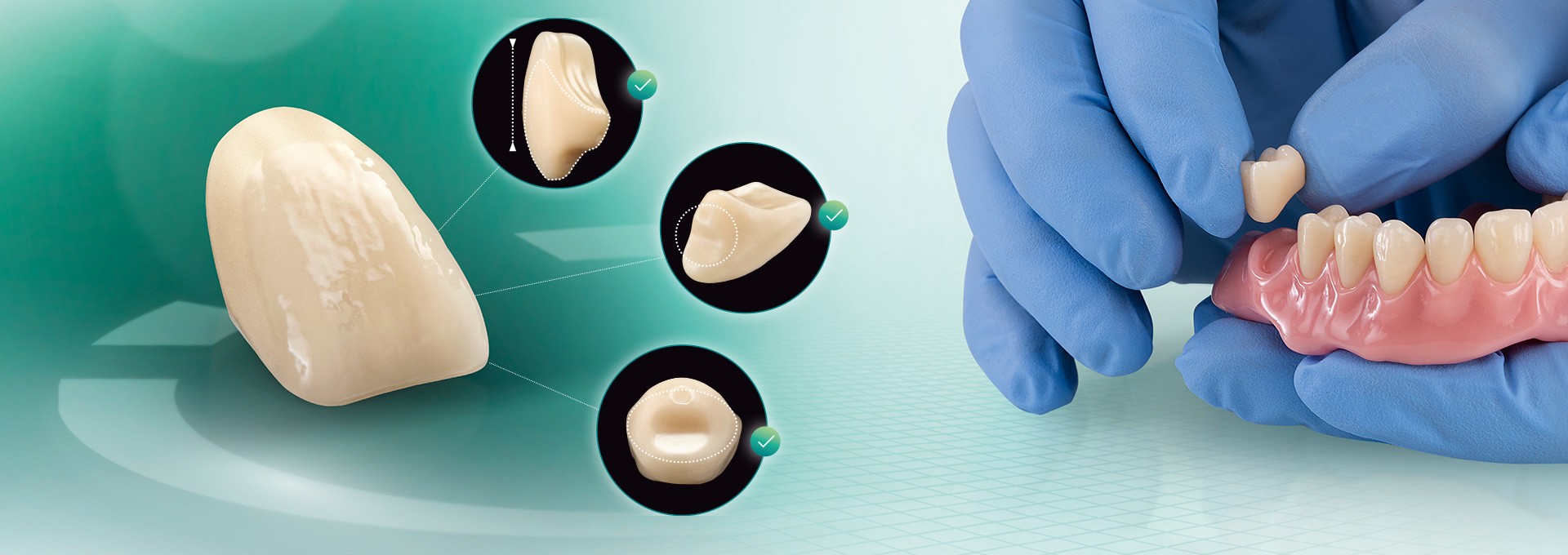 El diente VITA VIONIC VIGO desde distintas perspectivas y una prótesis confeccionada digitalmente.