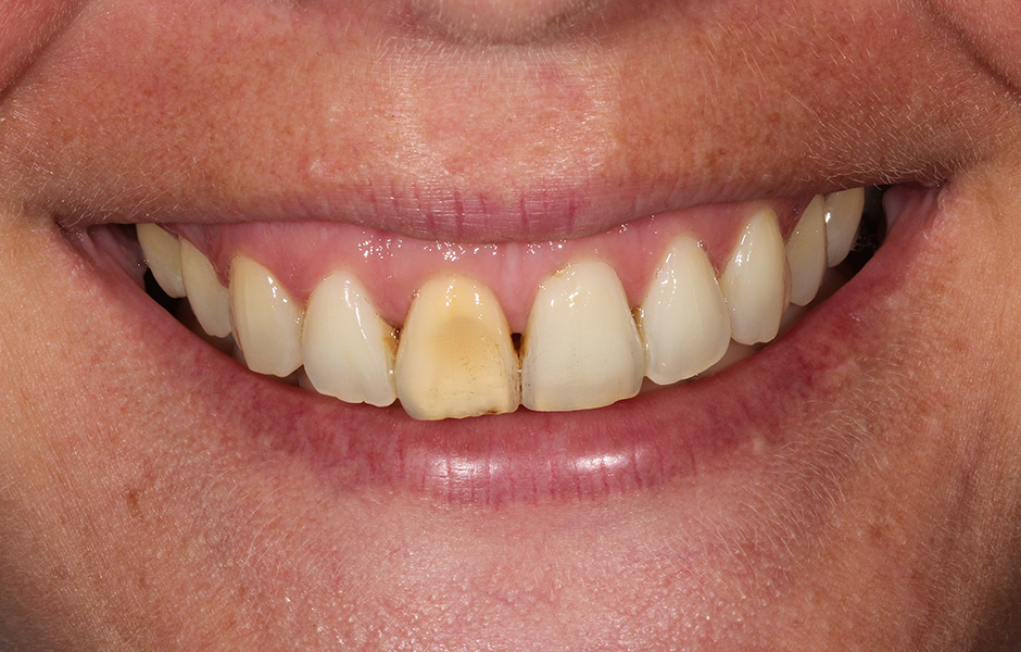 El protésico dental Okke Kamps comprueba en el ordenador el montaje virtual de los dientes.