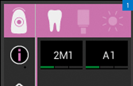 El color dental se determinó con precisión mediante el espectrofotómetro VITA Easyshade V.