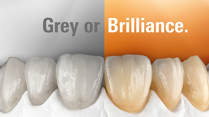 Brilliant dental technology deserves brilliant ceramics